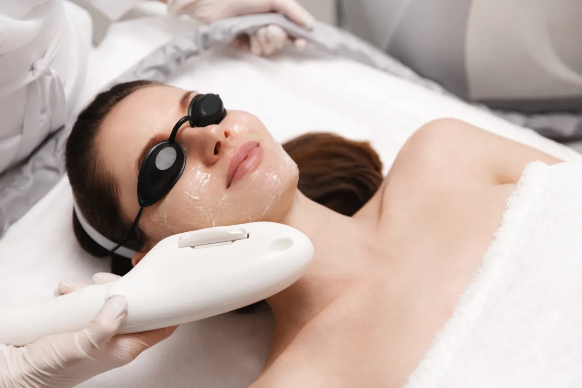Everything You Need to Know About Laser Photofacial