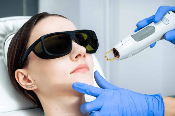 Portrait of a lady getting laser treatment | Laser Photofacial In San Marcos, CA | Injex Aesthetics and Wellness